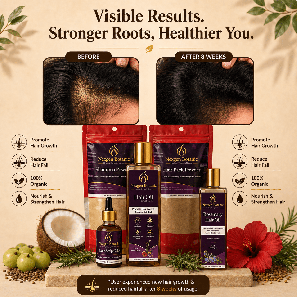Advanced Hair Growth Therapy Combo - NexGen Botanic