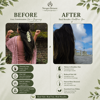 Advanced Hair Growth Therapy Combo - NexGen Botanic