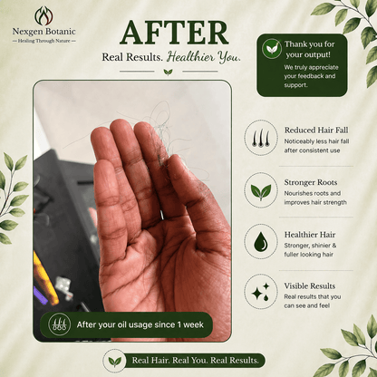 Advanced Hair Growth Therapy Combo - NexGen Botanic
