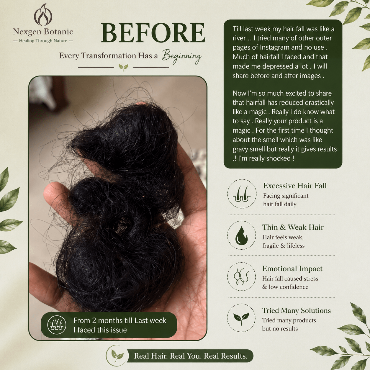 Advanced Hair Growth Therapy Combo - NexGen Botanic