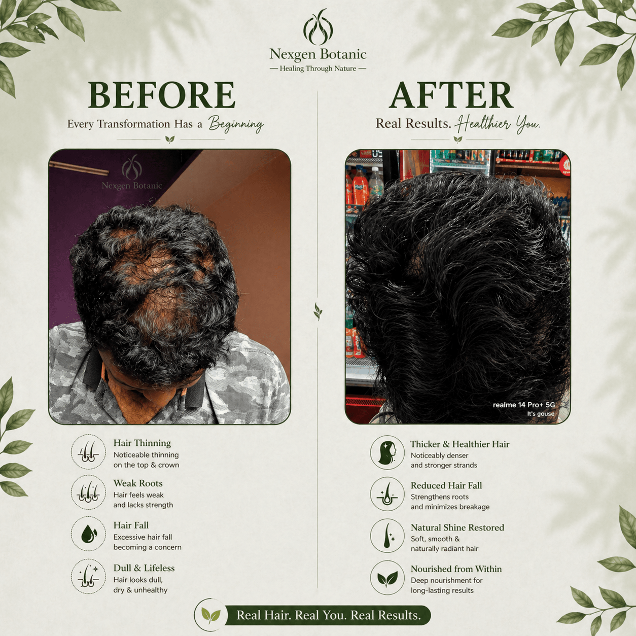 Advanced Hair Growth Therapy Combo - NexGen Botanic