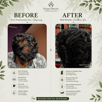 Advanced Hair Growth Therapy Combo - NexGen Botanic