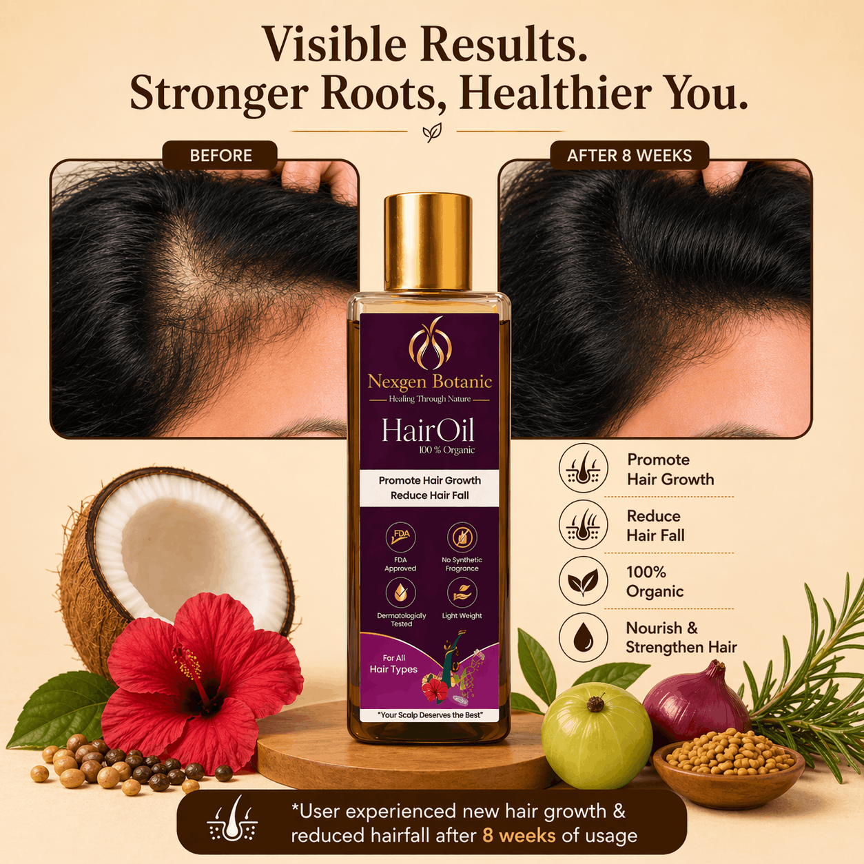 NexGen Botanic Hair Growth Oil - NexGen Botanic