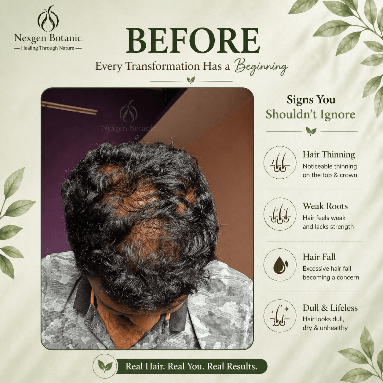 Root Revival Hair Growth Combo - NexGen Botanic