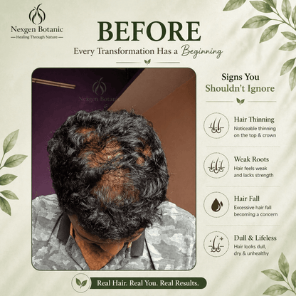 Root Revival Hair Growth Combo - NexGen Botanic