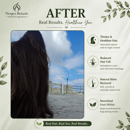 Root Revival Hair Growth Combo - NexGen Botanic