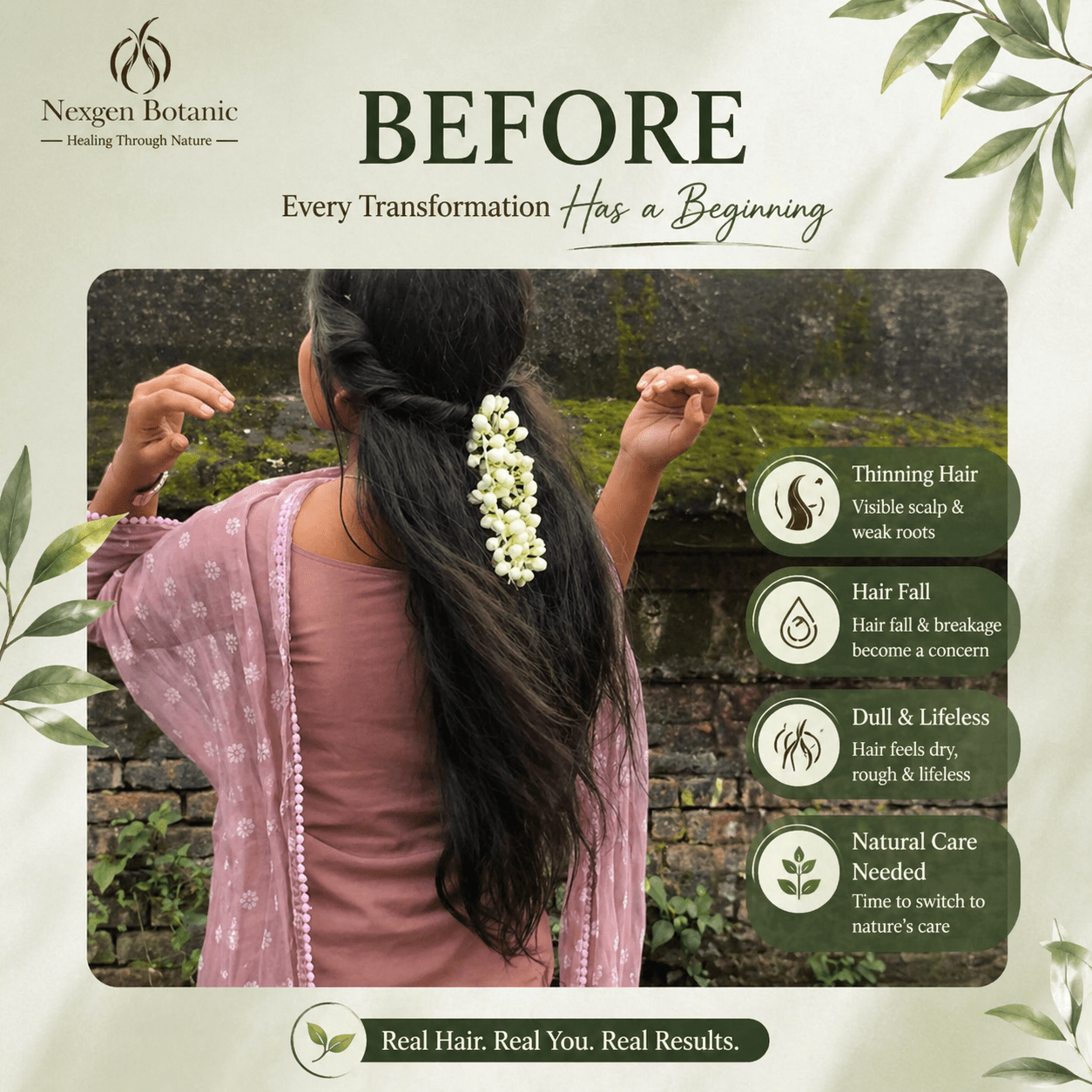 Root Revival Hair Growth Combo - NexGen Botanic
