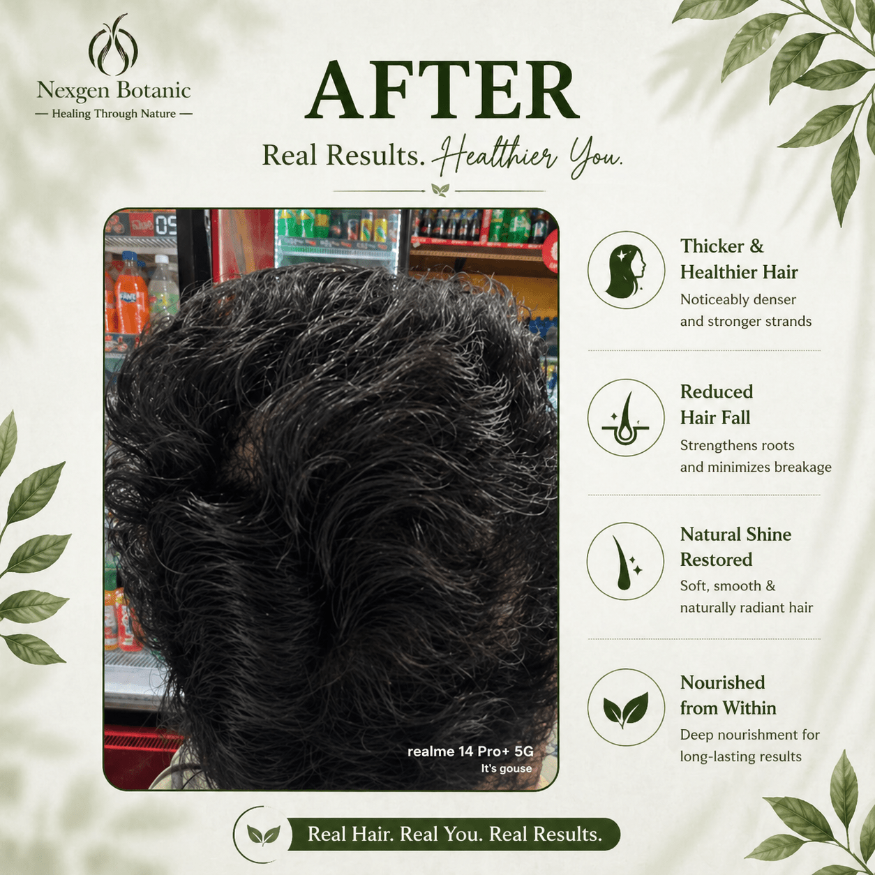 Root Revival Hair Growth Combo - NexGen Botanic