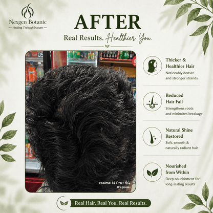 Root Revival Hair Growth Combo - NexGen Botanic